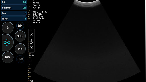 SmartUSG screenshot 4