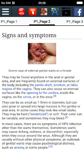 Genital wart  Educational App
