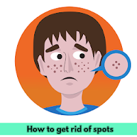 How to get rid of spots, acne, pimples and more