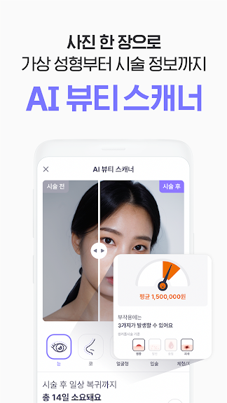 바비톡 - 성형 & 피부시술 정보 앱_6