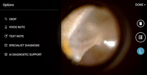 Android application hearScope screenshort