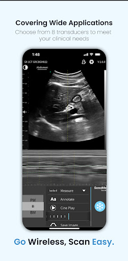 SonoMe Pro Screenshot 3