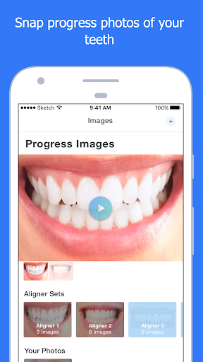 Smart Smile App