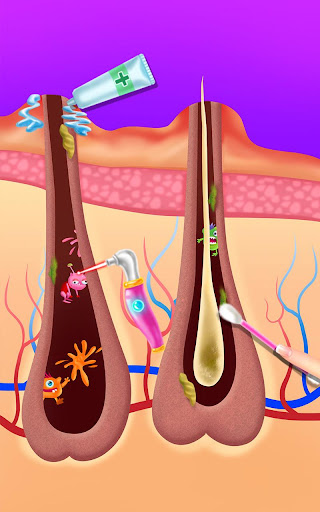 Makeup Artist - Pimple Salon Screen 3