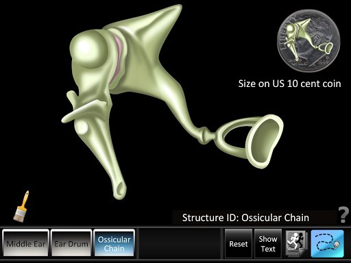 Middle Ear ID Screen 3