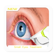 Small Eyes Treatment