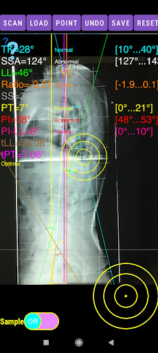 Sagittal Balance App screenshot 10