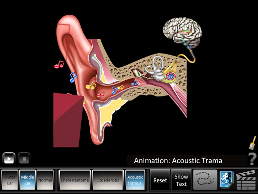Ear Disorders - Outer Middle Screen 2