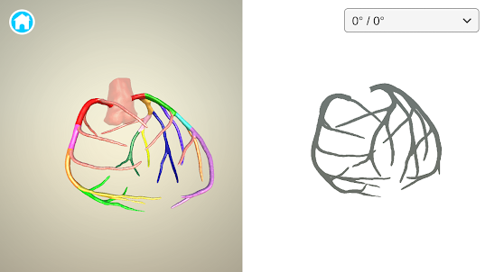 CAG angle simulator