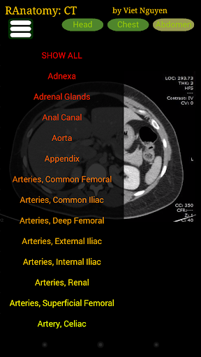 Radiology CT Anatomy Screen 3
