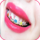 Real Braces teeth And Eyes icon