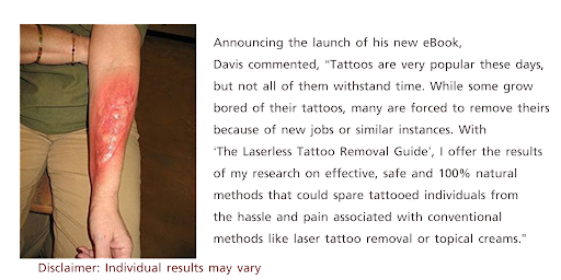 Android application Natural Tattoo Removal screenshort