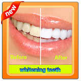 teeth whitening bleach icon
