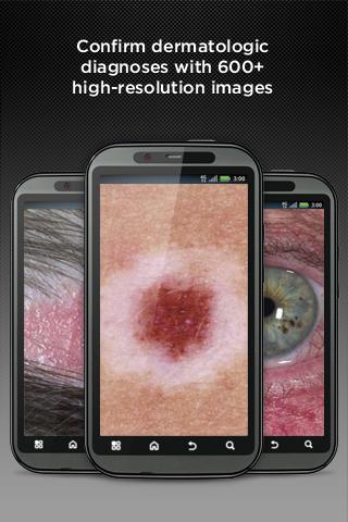 Dermatology DDx - 2.8.23 - (Android)