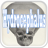 Hydrocephalus Disease icon