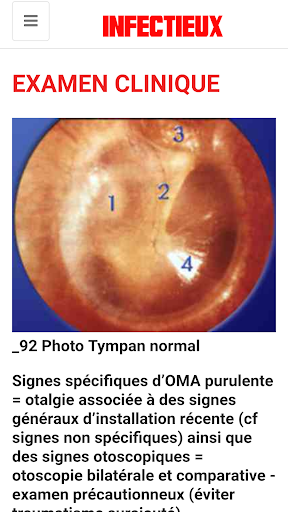 Infectious disease screenshot 11