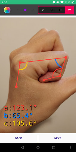 Angulus Classic - Use New App Screen 3