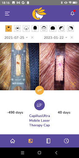 MyHairCounts Screen 2
