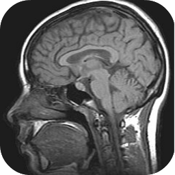 Icon image MRI Viewer