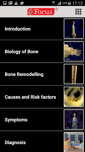 Osteoporosis Screen 2
