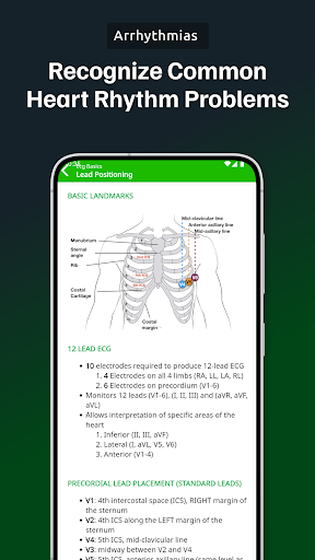 ECG Academy | ECG Made Easy screenshot 3