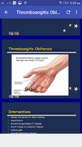Peripheral Vascular Diseases and their Management