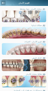 صورة لقطة الشاشة