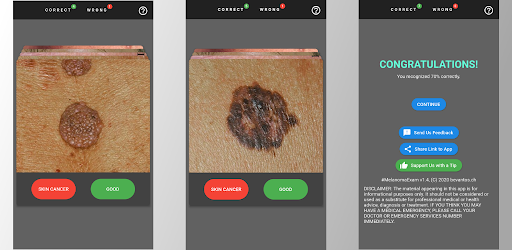 MelanomaExam Screen 3