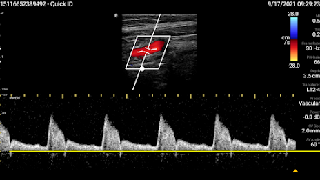 Philips Lumify Ultrasound App poster 5