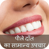 पीले दाँत का सामान्य उपचार icon