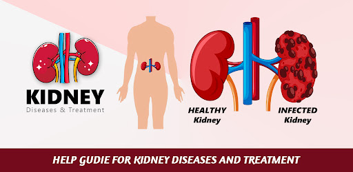 Kidney Diseases and Treatment
