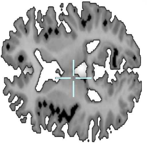 Brain viewer  Icon