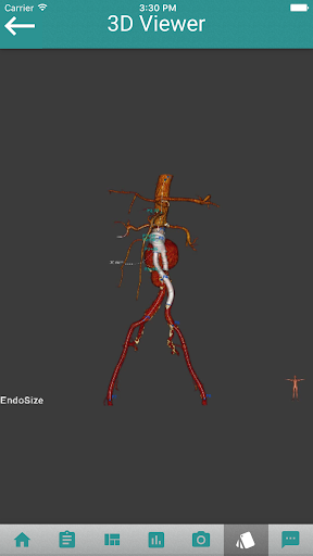 EndoSizeMe Screen 3