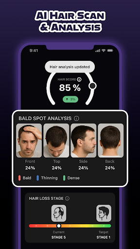 Screenshot of HairCode·Hair Loss Scanner AI