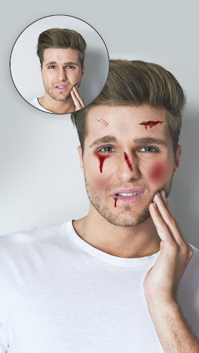 Injury on Face Photo Maker Screen 2