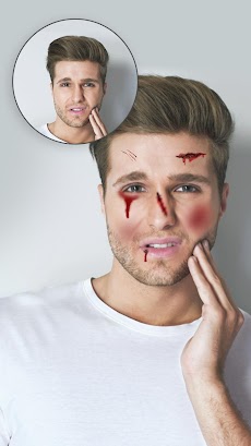 Injury on Face Photo Makerのおすすめ画像2