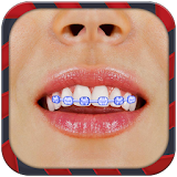 Braces Booth Camera Selfie icon