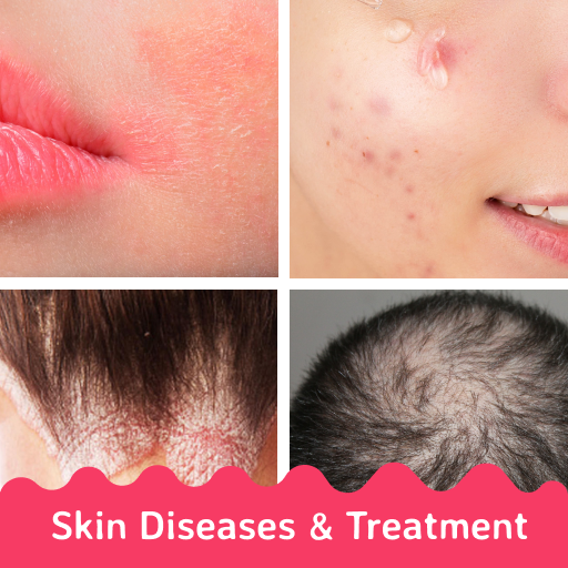 Skin Diseases and Treatments 4.4.0 Icon
