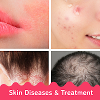 All Skin Diseases and Treatments - Skin care guide
