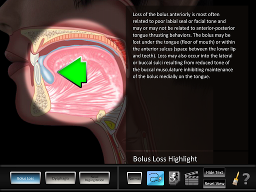 Swallowing Oral Screen 2