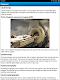 screenshot of Uterine Fibroid Treatment Help