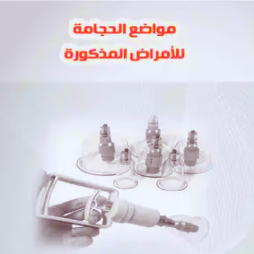 مواضع الحجامة