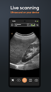 Clarius Ultrasound Screenshot