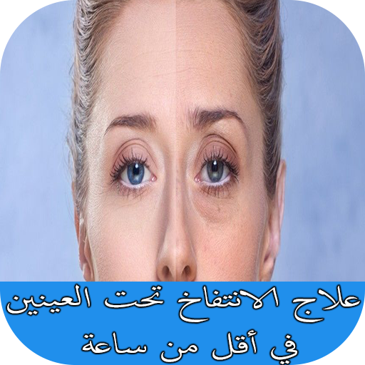 علاج الانتفاخ تحت العينين في أقل من ساعة Apps On Google Play