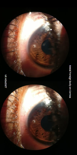 3D Atlas of Ophthalmology Screen 3