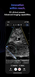 Butterfly iQ u2014 Ultrasound  Screenshots 2