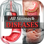 Cover Image of Télécharger Stomach Diseases & Treatment  APK