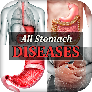Stomach Diseases & Treatment