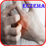 Top 43 Medical Apps Like Eczema Causes, Diagnosis, and Management - Best Alternatives