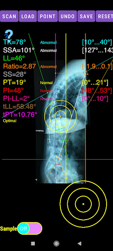 Sagittal Balance App screenshot 1